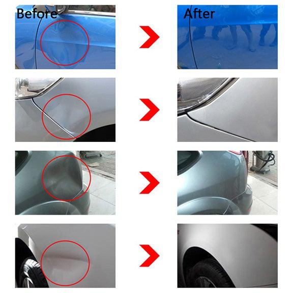 Paintless Dent Repair Kit Puller, Dent Puller, Car Dent Remover, Hail Damage Repair