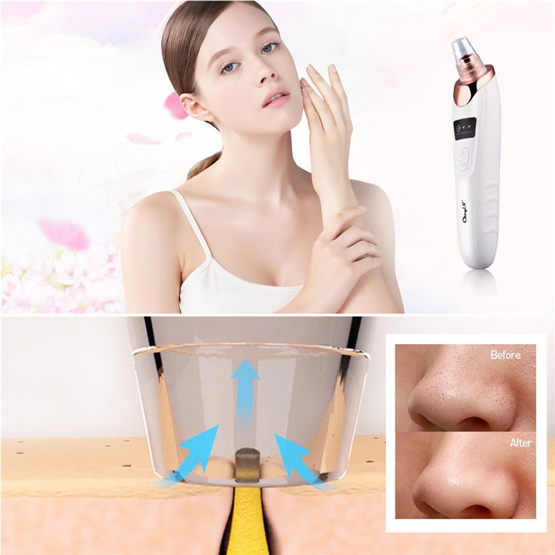 Facial Skin Ultrasonic Scrubber Blackhead Ance Remover Deep Cleansing Brush Anti Wrinkle Silicone Beauty Machine EMS Face Skin Care