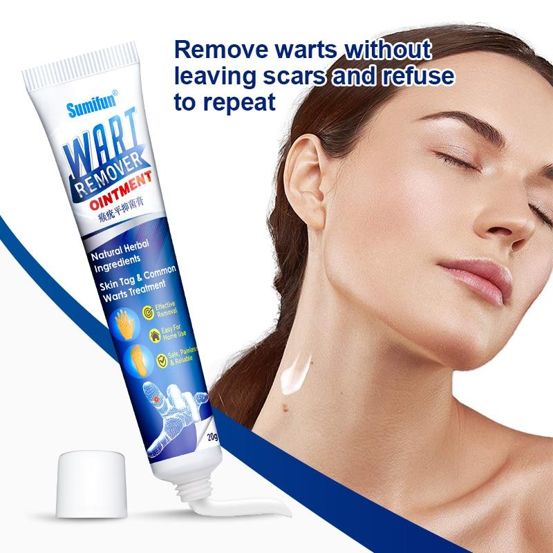 Warts Remover Ointment, Warts & Skin Tags Removal Cream eczema Tags